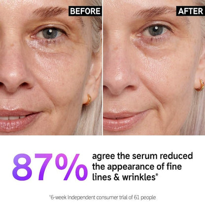 Fine Lines and Wrinkles Serum - 1 oz/30 ml